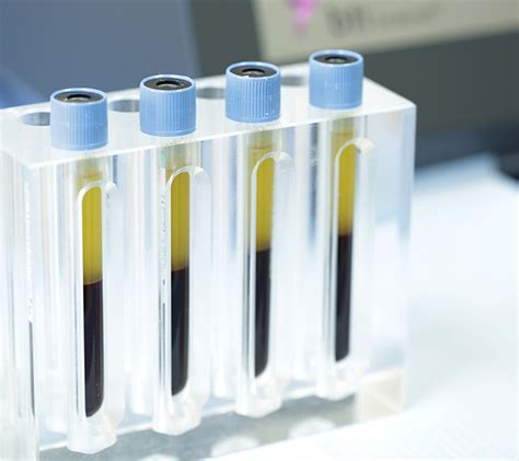 /cms/uploads/endoret tubes4.jpg